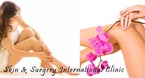 Hair_removal