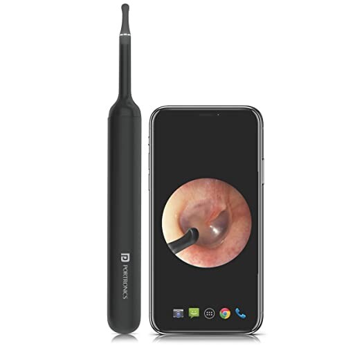 Portronics Xlife Smart Wireless Ear Otoscope Cleaner with 6 LED Lights(Black)