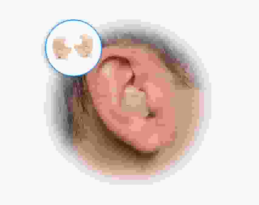 In-the-ear (ITE) hearing aids