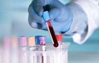 Pathology Tests | Upto 80% off