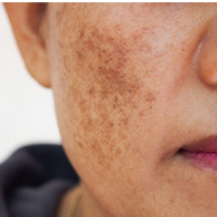 The Derma Co – Buy 1 Get 1 Free | Voucher Code Available